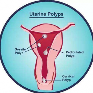 没有结婚证可以做试管吗？助孕生子需要注意哪些？