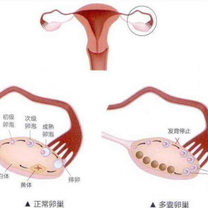 女性不结婚可以用助孕中心的公细胞生孩子吗？